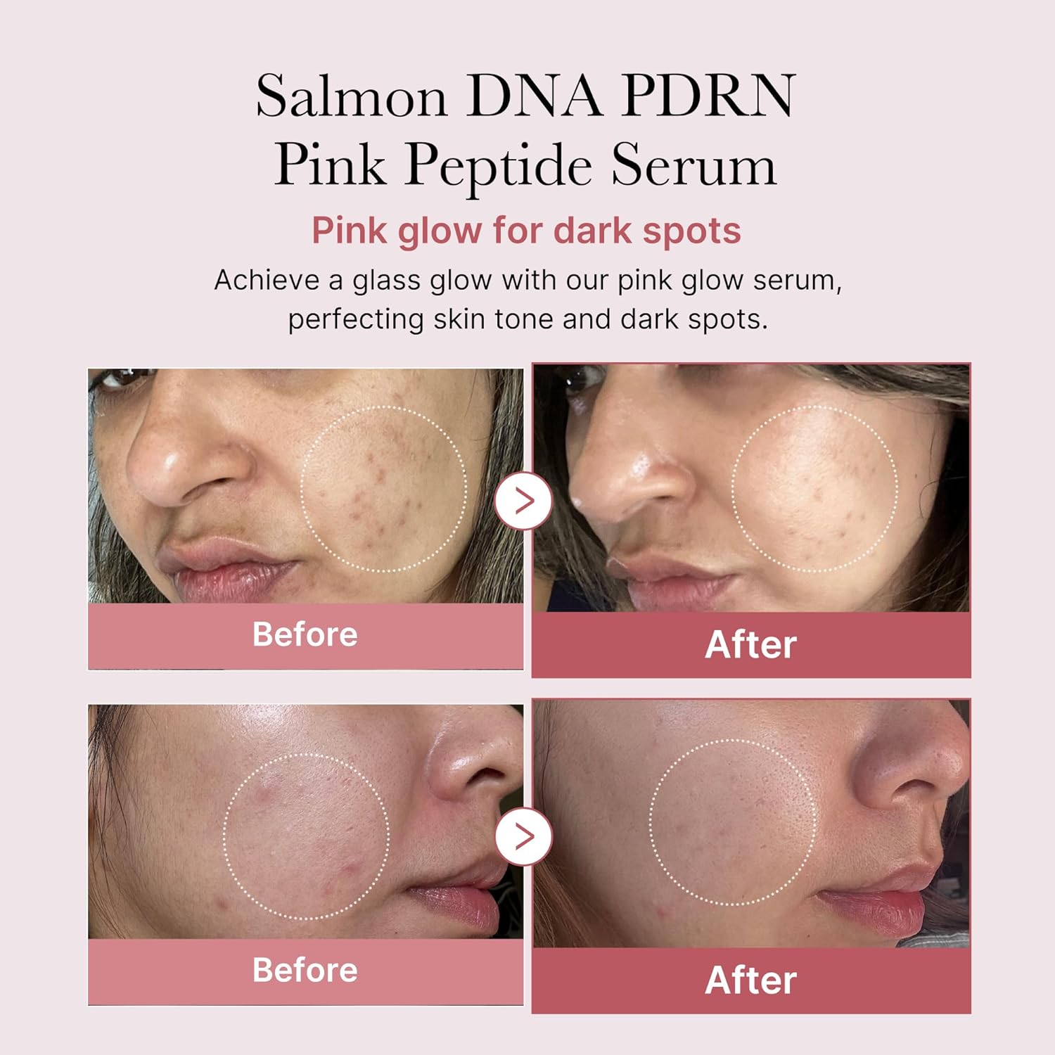 LAAYLA™ REJU-ALL DNA Salmon PDRN Rejuvenating Cream – Anti-Aging & Skin Repair