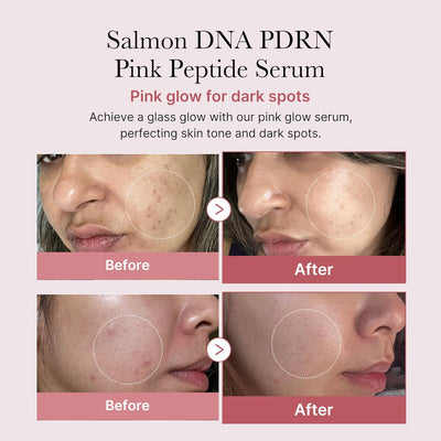 LAAYLA™ REJU-ALL DNA Salmon PDRN Rejuvenating Cream – Anti-Aging & Skin Repair